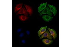 ABIN6255799 and ABIN6277803 staining Hela cells(4h of LPS treatment) by IF/ICC. (ERBB3 Antikörper  (pTyr1289))