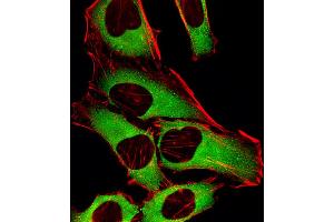 Fluorescent image of Hela cells stained with CRTAP Antibody (N-term).