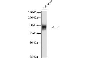 Western blot analysis of extracts of Rat brain, using S antibody (ABIN7270152) at 1:500 dilution. (SATB2 Antikörper)