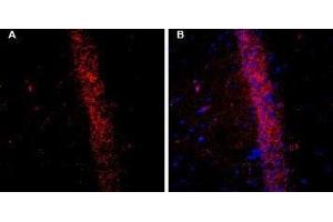 Expression of KCNQ2 in rat brain - Immunohistochemical staining of free-floating frozen rat hippocampal CA1 region sections using Guinea pig Anti-KCNQ2 Antibody (ABIN7043504, ABIN7045416 and ABIN7045417), (1:200). (KCNQ2 Antikörper  (C-Term, Intracellular))