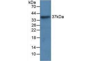 Western blot analysis of recombinant Human LRG1. (LRG1 Antikörper  (AA 37-340))