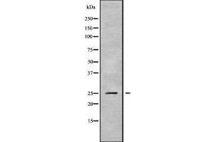 Western Blotting (WB) image for anti-Proteasome (Prosome, Macropain) 26S Subunit, Non-ATPase, 9 (PSMD9) (N-Term) antibody (ABIN6264492)