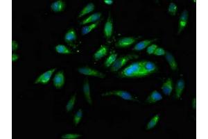 Immunofluorescence staining of Hela cells with ABIN7161406 at 1:166, counter-stained with DAPI. (PNPLA6 Antikörper  (AA 345-493))