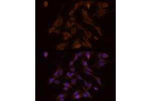 Immunofluorescence analysis of PC-12 cells using PFKFB3 Rabbit mAb (ABIN1680620, ABIN3018306, ABIN3018307 and ABIN7101590) at dilution of 1:100 (40x lens). (PFKFB3 Antikörper)