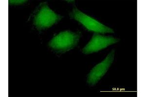 Immunofluorescence of purified MaxPab antibody to NEDD9 on HeLa cell. (NEDD9 Antikörper  (AA 1-834))