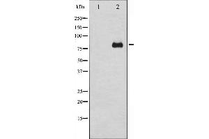 Western blot analysis of PKC delta expression in HeLa whole cell lysates,The lane on the left is treated with the antigen-specific peptide. (PKC delta Antikörper)
