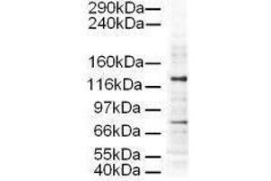 Western blot using  Affinity Purified anti-AP3D1 antibody shows detection of a 130-kDa band corresponding to Human AP3D1 in a HeLa whole cell lysate. (AP3D1 Antikörper  (AA 686-698))