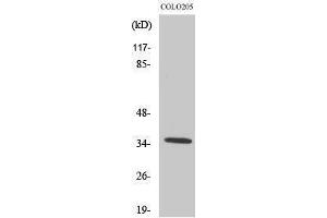 Western Blotting (WB) image for anti-Olfactory Receptor, Family 52, Subfamily D, Member 1 (OR52D1) (C-Term) antibody (ABIN3186129) (OR52D1 Antikörper  (C-Term))
