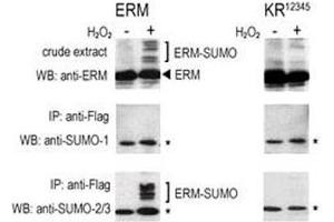 COS-7 cells were transfected for 24 hrs with a plasmid expressing FLAG-ERM (left panels) or FLAG-ERM KR12345 (right panels). (SUMO2/3 Antikörper  (AA 49-81))