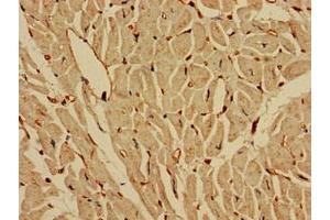 Immunohistochemistry of paraffin-embedded human heart tissue using ABIN7157046 at dilution of 1:100 (IREB2 Antikörper  (AA 107-216))
