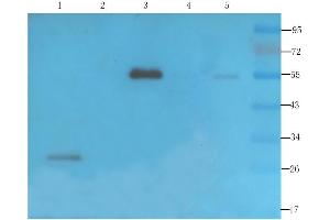 Western Blot using anti-VEGF antibody  Rat thyroid (lane 1), rat bladder (lane 2), mouse brain (lane 3), human thyroid cancer (lane 4) and human ovarian cancer (lane 5) samples were resolved on a 12% SDS PAGE gel and blots probed with  at 2 µg/ml before being detected by a secondary antibody.