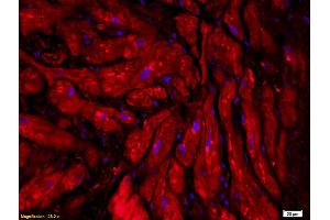 Formalin-fixed and paraffin embedded human myocardial tissue labeled with Anti-CT-1/CTF1 Polyclonal Antibody, Unconjugated (ABIN741675) followed by conjugation to the secondary antibody (Cardiotrophin 1 Antikörper  (AA 121-201))