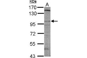 Western Blotting (WB) image for anti-Discs, Large (Drosophila) Homolog-Associated Protein 2 (DLGAP2) (AA 1-47) antibody (ABIN1502171) (DLGAP2 Antikörper  (AA 1-47))