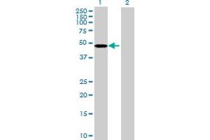 Western Blot analysis of ARMC6 expression in transfected 293T cell line by ARMC6 MaxPab polyclonal antibody. (ARMC6 Antikörper  (AA 1-476))