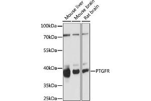 Western blot analysis of extracts of various cell lines, using PTGFR antibody (ABIN7269574) at 1:1000 dilution. (PTGFR Antikörper  (AA 50-150))