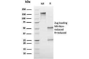 SDS-PAGE Analysis Purified CD1a Mouse Monoclonal Antibody (C1A/3249). (CD1a Antikörper  (AA 43-173))