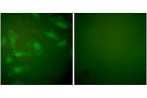 Immunofluorescence analysis of HeLa cells, using DJ-1 Antibody. (PARK7/DJ1 Antikörper  (AA 21-70))
