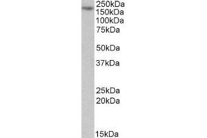 ABIN2564005 (1µg/ml) staining of Jurkat lysate (35µg protein in RIPA buffer). (MYO5A Antikörper  (Internal Region))