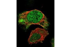 Immunofluorescent staining of human cell line U-2 OS with BNC2 polyclonal antibody  at 1-4 ug/mL dilution shows positivity in nucleus and cytoplasm.