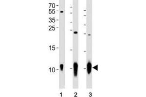 Western blot analysis of lysate from (1) A431 cell line, (2) mouse brain and (3) rat brain tissue using S100B antibody at 1:1000. (S100B Antikörper)