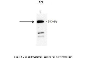 Amount and Sample Type : GFP-hRinl transfected COS7 cell lysate Amount of IP Antibody : 10ug Primary Antibody : anti-GFP Primary Antibody Dilution : 1:1000 Secondary Antibody : Goat anti-rabbit-HRP Secondary Antibody Dilution : 1:5000 Gene Name : RINL Submitted by : Barbara Woller; Medical University of Vienna (RINL Antikörper  (N-Term))