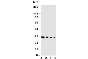 Western blot testing of GDNF antibody and Lane 1:  recombinant human protein 10ng (GDNF Antikörper  (Middle Region))