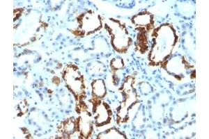 FFPE human renal cell carcinoma tested with Lactadherin antibody (EDM45) (MFGE8 Antikörper)