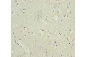 Immunohistochemistry of paraffin-embedded human brain tissue using ABIN7164067 at dilution of 1:100 (POU4F3 Antikörper  (AA 1-180))