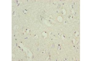 Immunohistochemistry (IHC) image for anti-POU Domain, Class 4, Transcription Factor 3 (POU4F3) (AA 1-180) antibody (ABIN7164067)