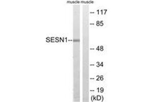 Western blot analysis of extracts from rat muscle cells, using SESN1 Antibody.