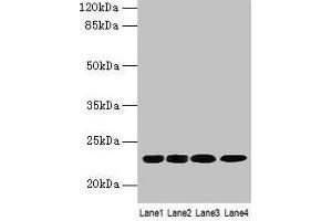 Western blot All lanes: CBX5 antibody at 9 μg/mL Lane 1: K562 whole cell lysate Lane 2: MCF-7 whole cell lysate Lane 3: 293T whole cell lysate Lane 4: Hela whole cell lysate Secondary Goat polyclonal to rabbit IgG at 1/10000 dilution Predicted band size: 23 kDa Observed band size: 23 kDa (CBX5 Antikörper  (AA 1-191))