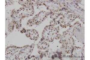 Image no. 1 for anti-ADP-Ribosylation-Like Factor 6 Interacting Protein 4 (ARL6IP4) (AA 261-361) antibody (ABIN466208) (ARL6IP4 Antikörper  (AA 261-361))