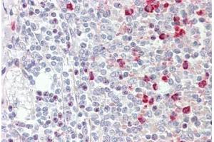 Immunohistochemistry (IHC) image for anti-Guanine Nucleotide Binding Protein (G Protein), Q Polypeptide (GNAQ) (AA 45-348) antibody (ABIN1804241)