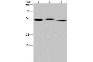 Western Blot analysis of Human kidney tissue, HepG2 cell and Human testis tissue using HYAL3 Polyclonal Antibody at dilution of 1:400 (HYAL3 Antikörper)