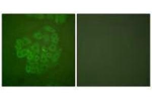 Immunofluorescence analysis of A549 cells, using GR (Ab-211) antibody. (Glucocorticoid Receptor Antikörper  (Ser211))