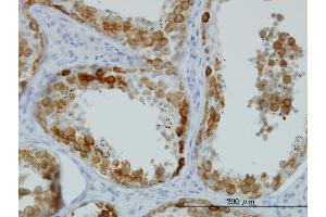 Immunostaining (ISt) image for anti-Deleted in Azoospermia 1 (DAZ1) (AA 21-120) antibody (ABIN560564)
