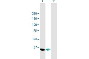 Western Blot analysis of PARVG expression in transfected 293T cell line by PARVG MaxPab polyclonal antibody.