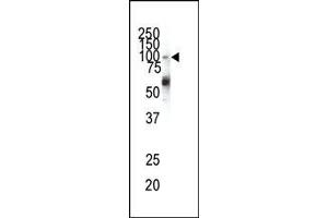 Western Blotting (WB) image for anti-Ephrin Type A Receptor 1 (EPHA1) (N-Term) antibody (ABIN359788)