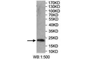 Western blot analysis of recombinant protein using SYT14 Antibody.