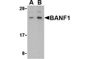 Western Blotting (WB) image for anti-Barrier To Autointegration Factor 1 (BANF1) (C-Term) antibody (ABIN1030282)