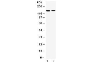 Western blot testing of human 1) HeLa and 2) MCF7 cell lysate with SAFB antibody at 0. (SAFB Antikörper  (AA 715-754))