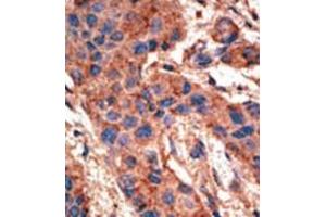 Image no. 2 for anti-Bone Morphogenetic Protein Receptor 1A (BMPR1A) (AA 39-69), (N-Term) antibody (ABIN357372)