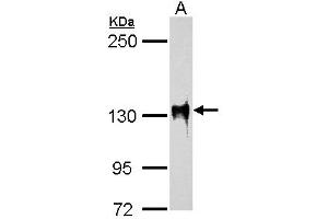 WB Image SAP130 antibody [C3], C-term detects SAP130 protein by western blot analysis. (SF3B3 Antikörper  (C-Term))