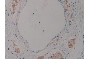 Immunohistochemistry (IHC) image for anti-Pro-Atrial Natriuretic Peptide (PRO-ANP) (AA 25-123) antibody (ABIN7431869)