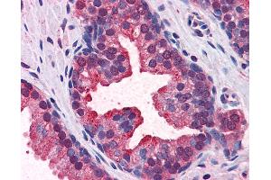 Anti-KEAP1 antibody IHC of human prostate. (KEAP1 Antikörper  (AA 21-70))