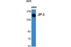 Western Blot (WB) analysis of specific cells using JIP-3 Polyclonal Antibody. (JIP3 Antikörper  (Internal Region))