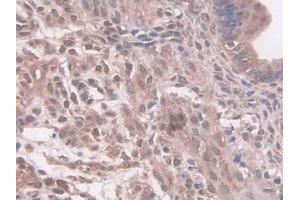 Detection of NAT1 in Mouse Uterus Tissue using Polyclonal Antibody to N-Acetyltransferase 1 (NAT1) (NAT1 Antikörper  (AA 9-254))