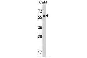 Western blot analysis of WDR1 Antibody (C-term) in CEM cell line lysates (35ug/lane).
