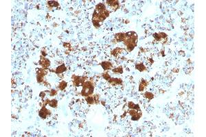 Formalin-fixed, paraffin-embedded human Pituitary stained with ACTH Monoclonal Antibody (SPM501). (POMC Antikörper  (AA 25-39))