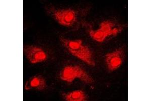 Immunofluorescent analysis of FOXO1 staining in MCF7 cells. (FOXO1 Antikörper  (Center))
